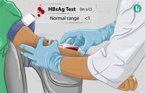 HBSAGTest .